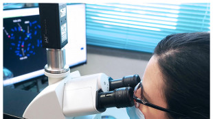 Scoperta la firma genetica del più aggressivo tumore al pancreas