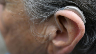 BGH urteilt Donnerstag zu Payback-Wertgutschriften beim Kauf von Hörgeräten