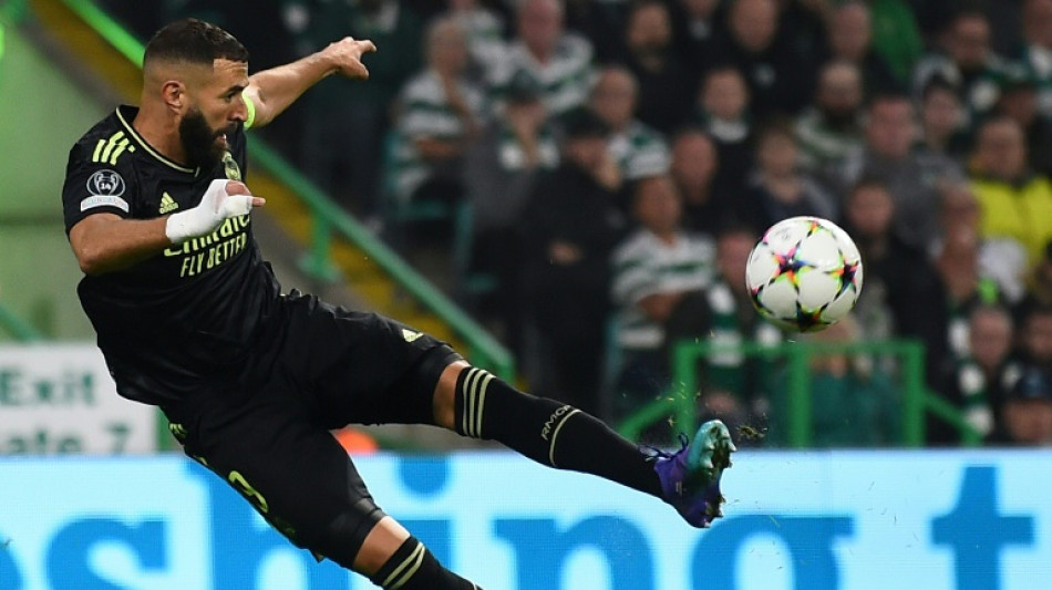 Benzema facing weeks out after injury at Celtic 