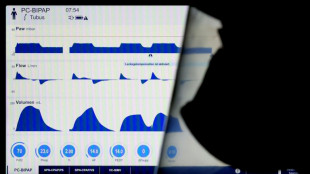 M&auml;nner sterben in Deutschland im Schnitt fast f&uuml;nf Jahre fr&uuml;her als Frauen