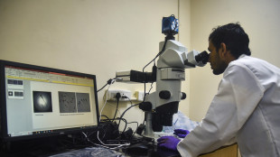 Scoperto come il cervello distingue la realt&agrave; dall'immaginazione