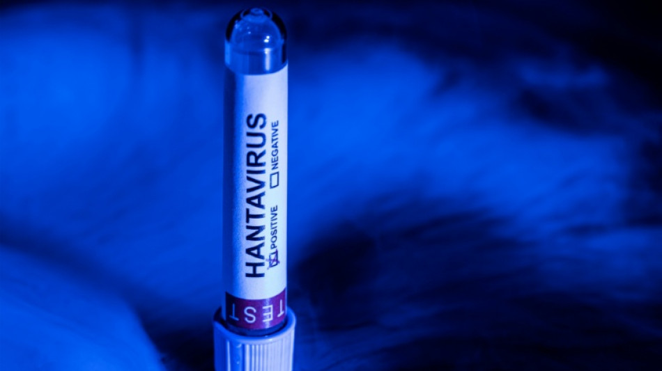 Turista franco-argentino testa positivo para hantav&iacute;rus, anuncia governo franc&ecirc;s