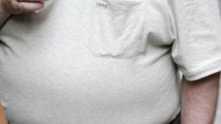 Con sovrappeso e obesit&agrave; cervello pi&ugrave; vecchio anche di due anni