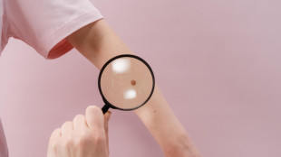 Moderna senza freni in Borsa, titolo vola a +130%