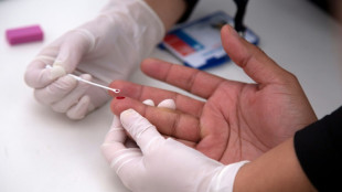 Acuerdo para distribuir gen&eacute;ricos de prevenci&oacute;n del VIH en pa&iacute;ses de bajos ingresos