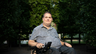 From 'magical' to 'rip it out': different brain implant experiences