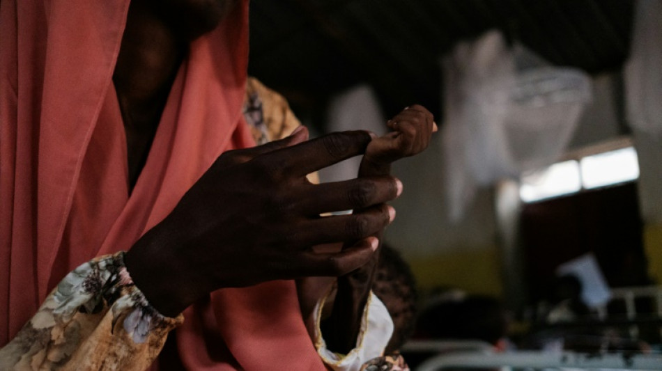 M&aacute;s de 3 millones de ni&ntilde;os corren el riesgo de sufrir desnutrici&oacute;n aguda en Sud&aacute;n, alerta la ONU