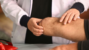 Cresce o n&uacute;mero de v&iacute;timas de minas terrestres na Col&ocirc;mbia